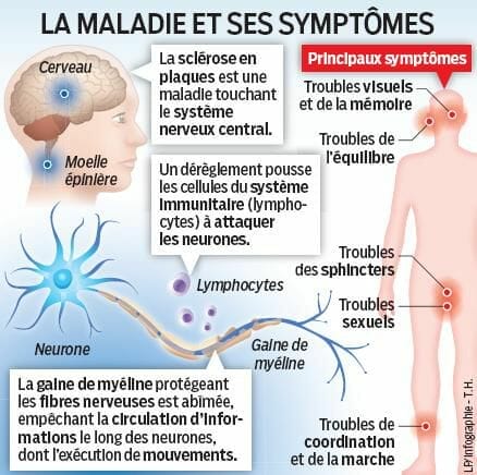 Symptômes_sclérose_en_plaques symptomes sclerose en plaques